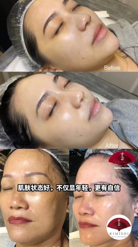 GlowMe by Kimisoi video ad thumbnail