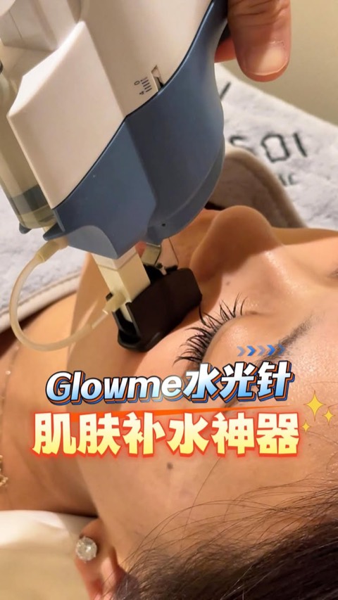 GlowMe by Kimisoi video ad thumbnail