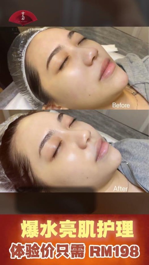 GlowMe by Kimisoi video ad thumbnail