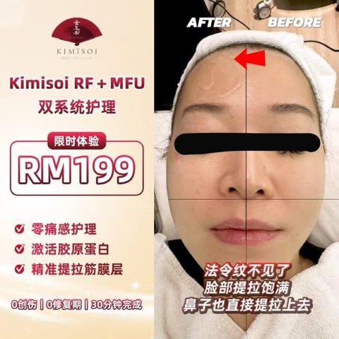 GlowMe by Kimisoi video ad thumbnail