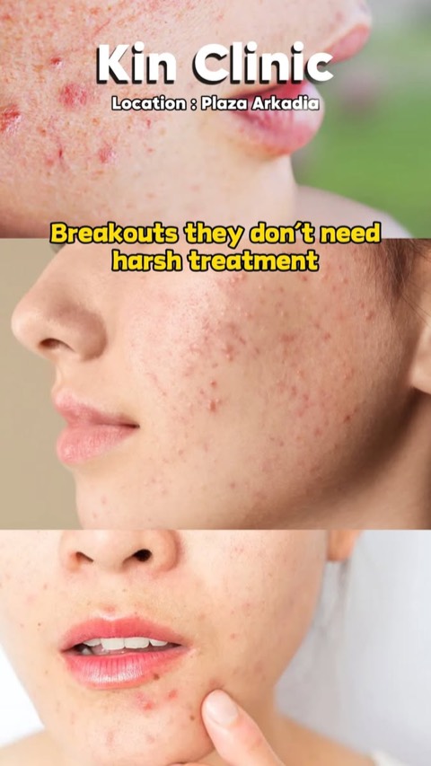 Kin Clinic video ad thumbnail